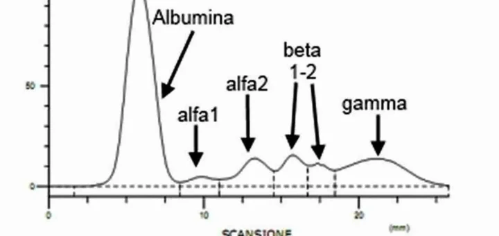 Elettroforesi